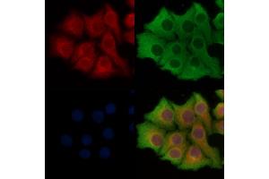 ABIN6261687 and ABIN6277900 staining Hela cells by IF/ICC. (SLC27A1 antibody  (Internal Region))