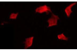 ABIN6274341 staining A549 by IF/ICC. (MDS1 antibody)