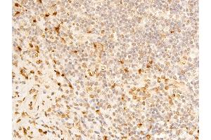 ABIN6267273 at 1/100 staining human appendiceal tissue sections by IHC-P. (Lamin A/C antibody  (pSer392))