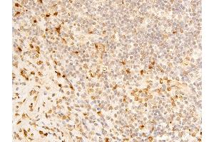 ABIN6267273 at 1/100 staining human appendiceal tissue sections by IHC-P. (Lamin A/C antibody  (pSer392))