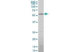 CYP26B1 polyclonal antibody (A01), Lot # ORU0060223QCS1 Western Blot analysis of CYP26B1 expression in K-562 . (CYP26B1 antibody  (AA 131-230))