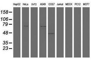 Image no. 1 for anti-HBS1-Like (HBS1L) (AA 1-260) antibody (ABIN1490655) (HBS1L antibody  (AA 1-260))