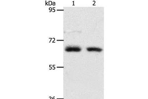 Western Blot analysis of Human fetal kidney and fetal lung tissue using ACOT11 Polyclonal Antibody at dilution of 1:450 (ACOT11 antibody)