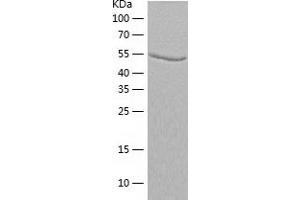 Western Blotting (WB) image for Adenylosuccinate Lyase (ADSL) (AA 1-484) protein (His tag) (ABIN7121722) (Adenylosuccinate Lyase Protein (ADSL) (AA 1-484) (His tag))