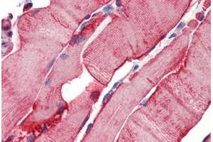 Human Skeletal Muscle (formalin-fixed, paraffin-embedded) stained with Heat Shock Protein 27 (HSP27) antibody ABIN462101 at 10 ug/ml followed by biotinylated goat anti-rabbit IgG secondary antibody ABIN481713, alkaline phosphatase-streptavidin and chromogen. (HSP27 antibody)