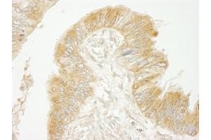 anti-ADP-Ribosylation Factor Guanine Nucleotide-Exchange Factor 2 (Brefeldin A-Inhibited) (ARFGEF2) (AA 300-350) antibody