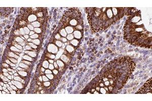 ABIN6272972 at 1/100 staining Mouse colon tissue by IHC-P.