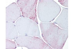 Anti-PYGM / Phosphorylase b antibody IHC of human skeletal muscle. (PYGM antibody  (AA 698-727))