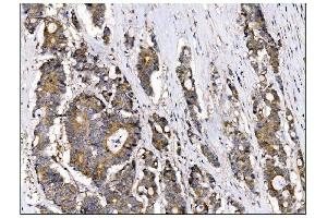 IHC analysis of AS160/TBC1D4 using anti-AS160/TBC1D4 antibody (ABIN7599745). (TBC1D4 antibody  (AA 1118-1298))
