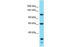 Western Blotting (WB) image for anti-KIAA1522 (KIAA1522) (C-Term) antibody (ABIN2791616) (KIAA1522 antibody  (C-Term))