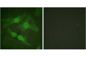 Immunofluorescence analysis of HeLa cells, using PKC zeta (phospho-Thr410) antibody.