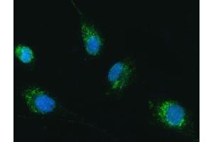 IF analysis of TRK fused gene/TFG using anti-TRK fused gene/TFG antibody (ABIN7599839). (TFG antibody  (AA 121-400))