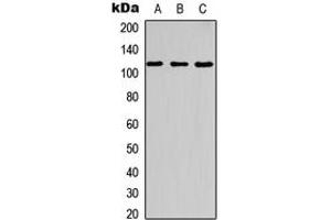 Western blot analysis of c-CBL (pY700) expression in HT29 UV-treated (A), NIH3T3 (B), rat kidney (C) whole cell lysates.