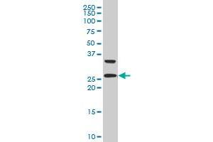 ARHGDIG polyclonal antibody (A01), Lot # 050921JC01 Western Blot analysis of ARHGDIG expression in 293 . (ARHGDIG antibody  (AA 1-225))