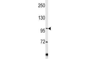 Western Blotting (WB) image for anti-Collagen, Type VI, alpha 1 (COL6A1) antibody (ABIN3002700) (COL6A1 antibody)