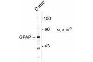 Image no. 1 for anti-Glial Fibrillary Acidic Protein (GFAP) antibody (ABIN303954) (GFAP antibody)
