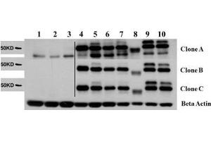 Western Blot of Rat Anti-AKT2 antibody. (V-Akt Murine Thymoma Viral Oncogene Homolog 2 (AKT2) Peptide)