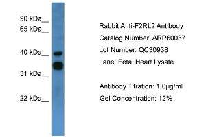 WB Suggested Anti-F2RL2  Antibody Titration: 0. (F2RL2 antibody  (C-Term))