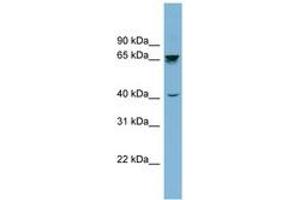Image no. 1 for anti-Acetylcholinesterase (AChE) (AA 359-408) antibody (ABIN6741992) (Acetylcholinesterase antibody  (AA 359-408))