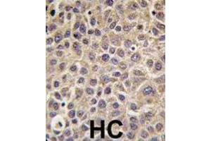 Immunohistochemistry (IHC) image for anti-Myotubularin Related Protein 8 (MTMR8) antibody (ABIN3002813)