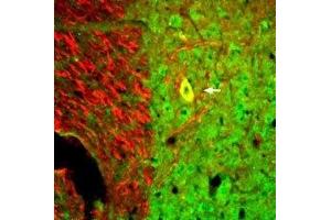 Immunohistochemistry (IHC) image for anti-Neurotrophin 3 (NTF3) (AA 177-186), (AA 39-48), (Intracellular) antibody (ABIN7043392)