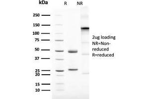 SDS-PAGE Analysis Purified Mammaglobin Recombinant Rabbit Monoclonal (MGB1/2123R).