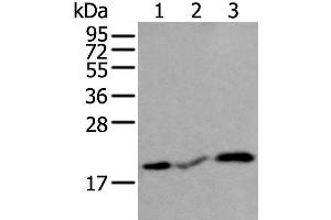 Western blot analysis of Human heart tissue Rat heart tissue and Mouse heart tissue lysates using CSRP3 Polyclonal Antibody at dilution of 1:400 (CSRP3 antibody)