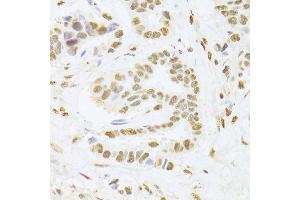 Immunohistochemistry (Paraffin-embedded Sections) (IHC (p)) image for anti-Acidic (Leucine-Rich) Nuclear phosphoprotein 32 Family, Member A (ANP32A) (AA 1-170) antibody (ABIN6136909)