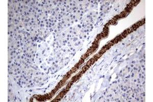 Image no. 1 for anti-Tuberous Sclerosis 1 (TSC1) (AA 836-1164) antibody (ABIN1491685) (TSC1 antibody  (AA 836-1164))