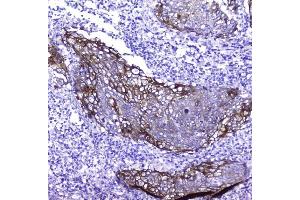 IHC analysis of Periplakin using anti-Periplakin antibody (ABIN5518787). (PPL antibody  (C-Term))