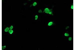 Image no. 1 for anti-T-Cell Acute Lymphocytic Leukemia 1 (TAL1) antibody (ABIN1501290)