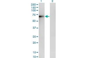 Western Blotting (WB) image for anti-ERO1-Like Protein alpha (ERO1L) (AA 90-179) antibody (ABIN599232) (ERO1L antibody  (AA 90-179))