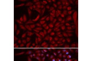Immunofluorescence analysis of U2OS cells using CUL5 Polyclonal Antibody (Cullin 5 antibody)