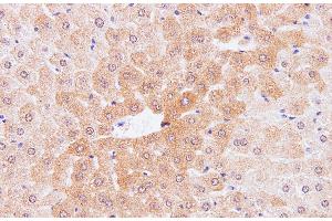 Immunohistochemistry of paraffin-embedded Mouse liver using IL2 Polyclonal Antibody at dilution of 1:100 (IL-2 antibody)