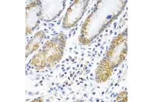 Immunohistochemistry of paraffin-embedded human stomach using ATAD3A antibody. (ATAD3A antibody)
