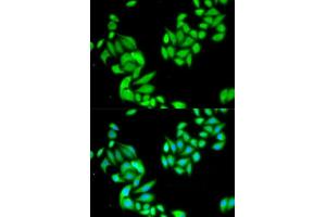 Immunofluorescence analysis of HeLa cell using IKBKB antibody. (IKBKB antibody  (AA 630-730))