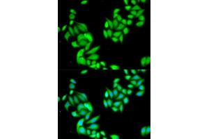 Immunofluorescence analysis of HeLa cell using IKBKB antibody. (IKBKB antibody  (AA 630-730))