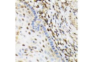 Immunohistochemistry of paraffin-embedded human esophageal using NRBF2 Rabbit pAb  at dilution of 1:100 (40x lens).
