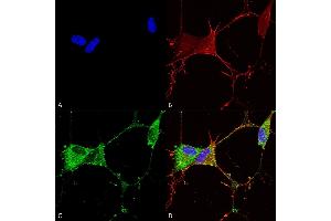 Immunocytochemistry/Immunofluorescence analysis using Mouse Anti-GABA-B Receptor 2 Monoclonal Antibody, Clone S81-2 (ABIN1686619). (GABBR2 antibody  (AA 861-912))