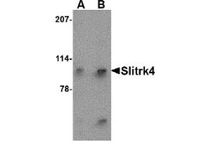 Western Blotting (WB) image for anti-SLIT and NTRK-Like Family, Member 4 (SLITRK4) (N-Term) antibody (ABIN1031578) (SLITRK4 antibody  (N-Term))