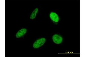 Immunofluorescence of monoclonal antibody to SRP68 on HeLa cell.