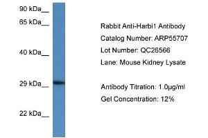 Western Blotting (WB) image for anti-Harbinger Transposase Derived 1 (HARBI1) (N-Term) antibody (ABIN2786327) (HARBI1 antibody  (N-Term))