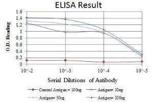 Red: Control Antigen (100 ng), Purple: Antigen (10 ng), Green: Antigen (50 ng), Blue: Antigen (100 ng), (SNAIL antibody)