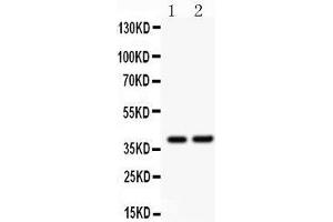 Western Blotting (WB) image for anti-SRY (Sex Determining Region Y)-Box 1 (SOX1) (AA 215-248), (Middle Region) antibody (ABIN3043439)
