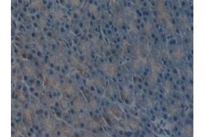Detection of uPA in Mouse Pancreas Tissue using Polyclonal Antibody to Plasminogen Activator, Urokinase (uPA) (PLAU antibody  (AA 180-433))
