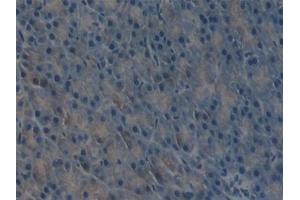 Detection of uPA in Mouse Pancreas Tissue using Polyclonal Antibody to Plasminogen Activator, Urokinase (uPA) (PLAU antibody  (AA 180-433))