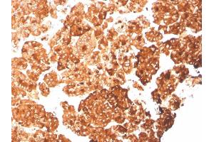 Formalin-fixed, paraffin-embedded human pancreas stained with KRT6A Recombinant Mouse Monoclonal Antibody (rKRT6A/2100).