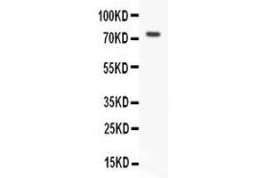 Western Blotting (WB) image for anti-Receptor (TNFRSF)-Interacting serine-threonine Kinase 1 (RIPK1) (AA 411-425), (Middle Region) antibody (ABIN3042930)