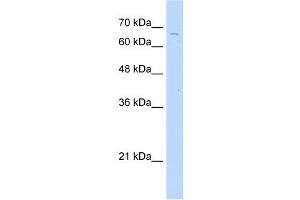 TKTL2 antibody used at 2. (TKTL2 antibody  (C-Term))