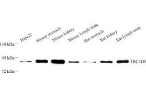 Western blot analysis of TBCD5 (ABIN7075848) at dilution of 1: 2000 (TBC1D5 antibody)